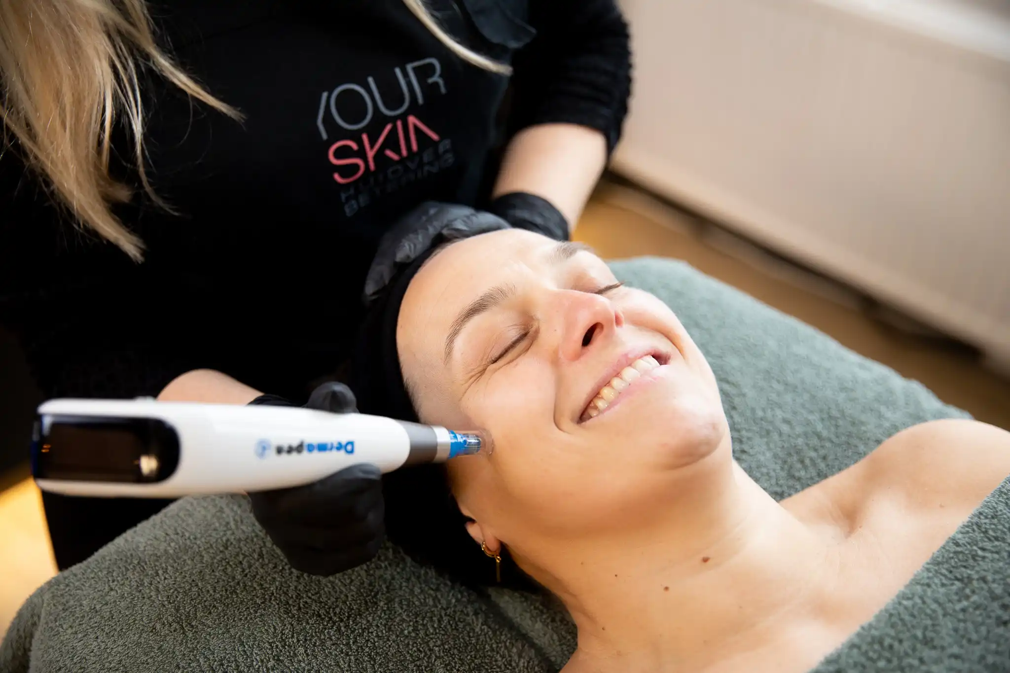 Acnebehandeling met Dermapen bij YOURSKIN in Apeldoorn