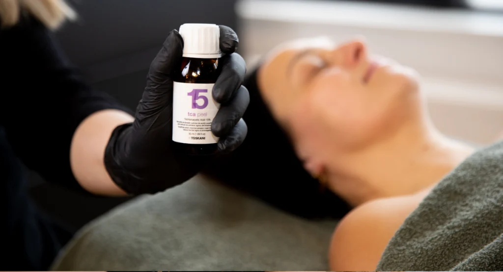 Wat-is-een-chemische-peeling